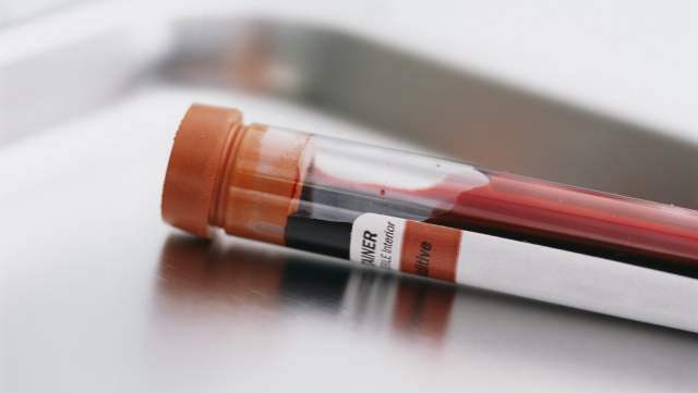 MS acordă suficiente fonduri pentru tratamentele pentru HIV - tratamentpreventivpentruhiv-1369050738.jpg