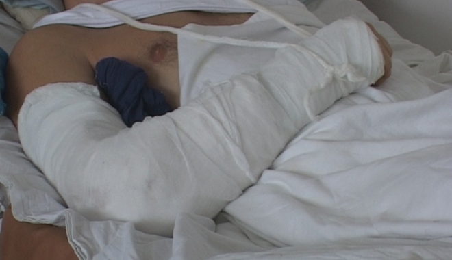 Plăgile tăiate cu flexul, tot mai frecvente - traumatismmaini-1487954432.jpg