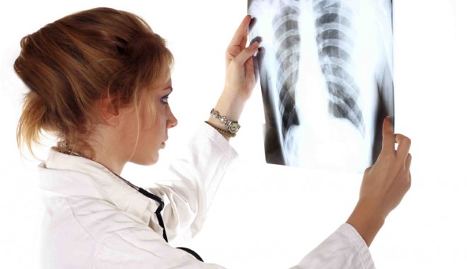 Tuberculoza, boala care face ravagii în organism - tuberculozaboala-1400512989.jpg