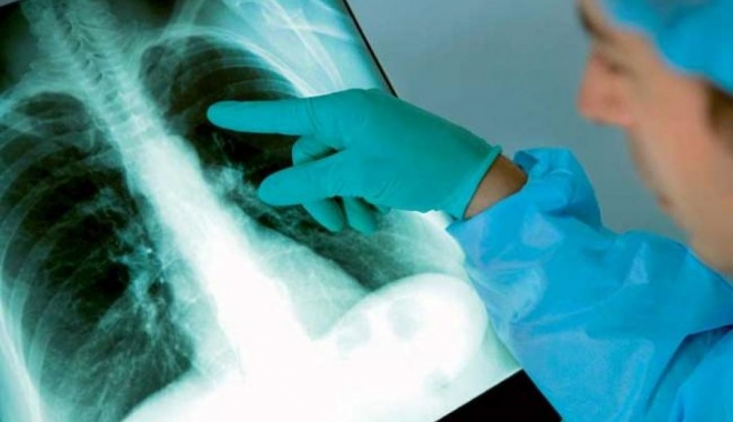 Bolnavii cu tuberculoză rezistentă, fără acces la tratament! - tuberculozaplamani-1464945322.jpg