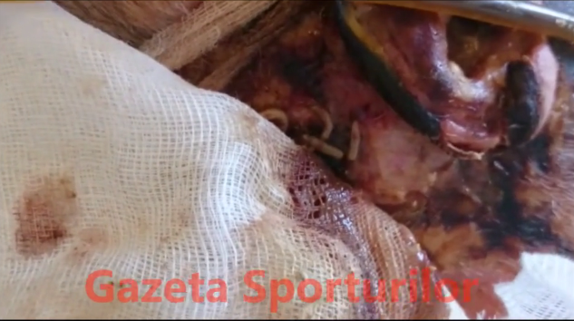 PACIENȚI MÂNCAȚI DE VIERMI, LA PROPRIU! IMAGINI ȘOCANTE FILMATE DE UN MEDIC. Bărbatul din video a decedat ulterior - untitled-1468478374.jpg