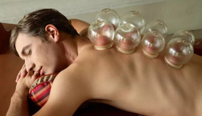 Terapia cu ventuze poate fi folosită și cu scop de detoxifiere - ventuze-1696507085.jpg