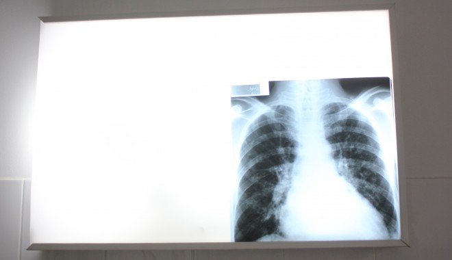 Iată unde puteți afla informații despre tuberculoză - veraenikopallpneumologradiografi-1376907489.jpg