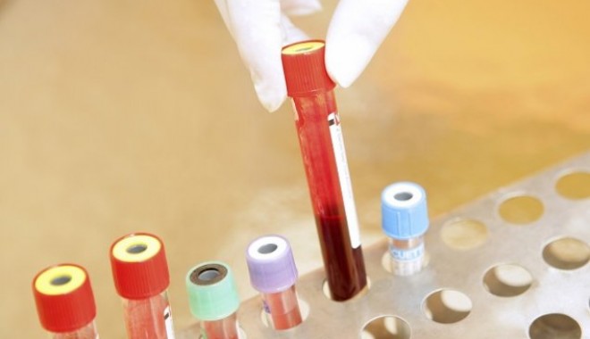 Anunțul medicilor cu privire la starea românului bolnav de malarie - virus-1407935903.jpg