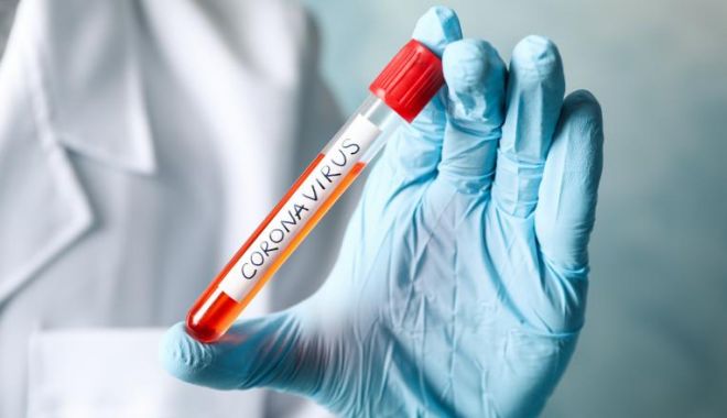 Alte două cazuri de coronavirus confirmate vineri, în România. Noul bilanț: 9 pacienți infectați cu COVID-19 - virus-1583515847.jpg