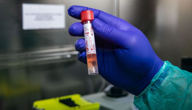 Un bărbat, confirmat cu coronavirus, a intrat în contact cu 150 de persoane înainte de a fi diagnosticat - virus-1584603688.jpg