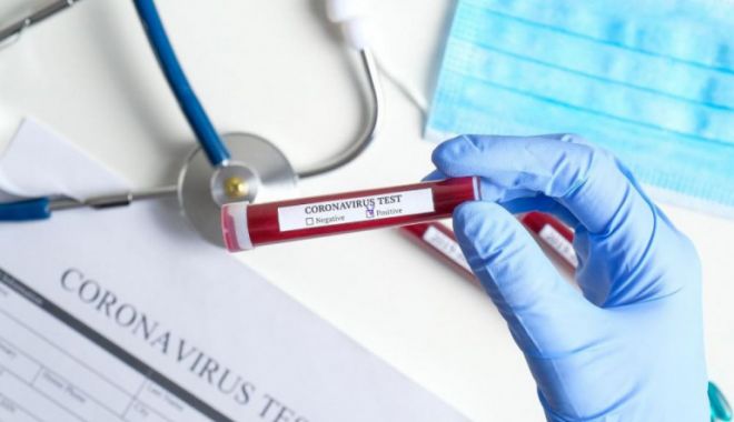 Un nou test pentru coronavirus, aprobat în Europa. Are o eficiență de 99% - virus-1588231152.jpg