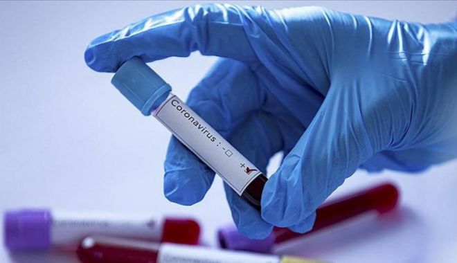Coronavirus în România: Încă 13 decese legate de coronavirus/ Bilanțul a ajuns la 1094 - virus-1589666601.jpg