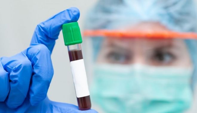 COVID-19. 167 de cazuri noi de îmbolnăvire, în toată țara - virus-1589710489.jpg
