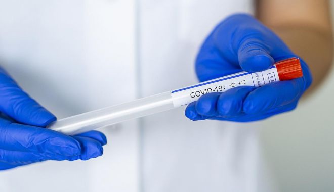 Bucureștenii se testează împotriva noului coronavirus - virus-1590392159.jpg