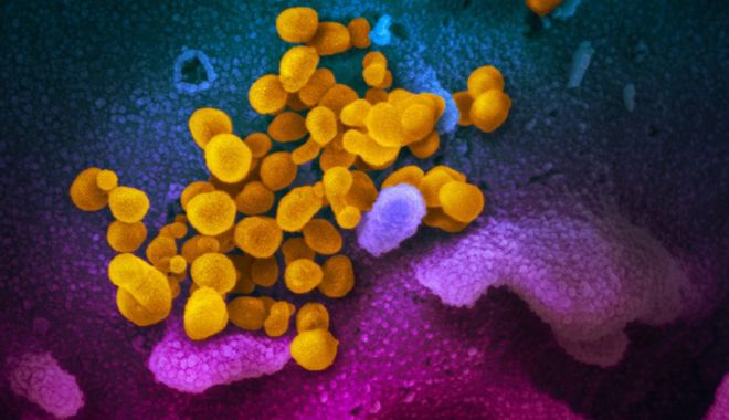 România și Suedia, țările cu cele mai multe decese de Covid-19 raportate la populație în ultimele 14 zile - virus-1596020970.jpg