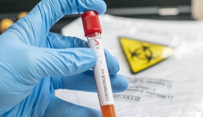 Alte 1.111 cazuri noi de coronavirus. 16 sunt la Constanţa - virus-1600168074.jpg