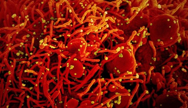 Varianta sud-africană și cea britanică a coronavirusului continuă să se extindă - virus-1611131953.jpg
