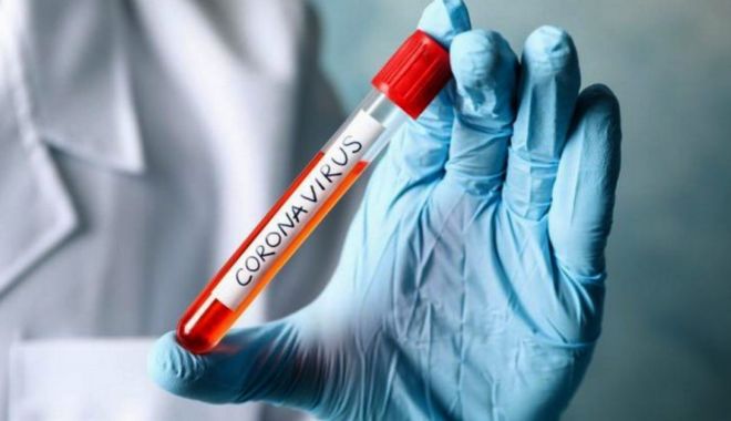 COVID-19. 166 de cazuri noi, în 24 de ore în țară. Nicio îmbolnăvire, la Constanța. - virus2-1592215971.jpg