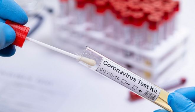 COVID-19. Alte 11 cazuri noi, la Constanța - virus2-1592823364.jpg
