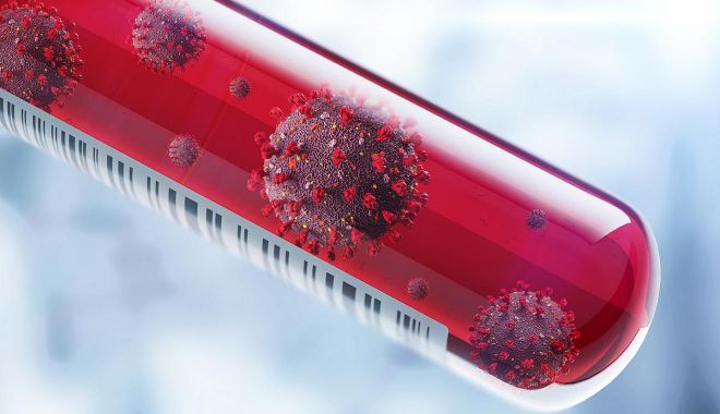 COVID-19. Mai puține teste, mai puține cazuri de infectări cu coronavirus - virus2-1595844579.jpg