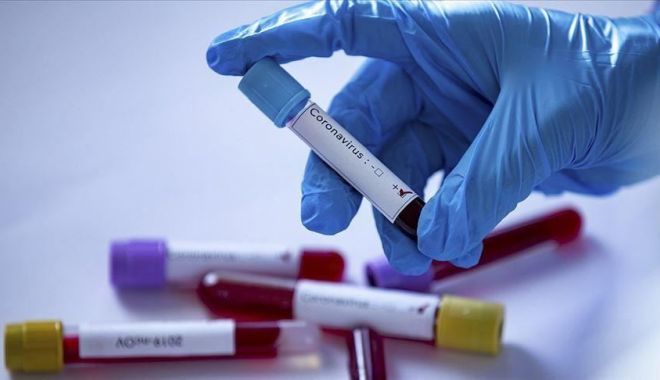 Bilanțul Covid-19 pe județe. Cele mai multe cazuri - în București, Suceava, Argeș și Brașov - virus2-1598786269.jpg