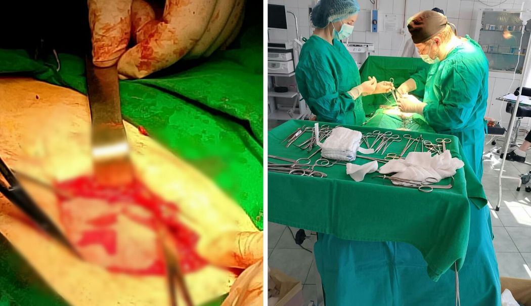 Caz medical rar operat cu succes la Spitalul Orășenesc Hârșova - x-operatie-1754995351.jpg