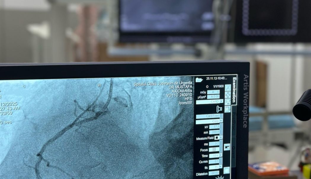 Medicii constănțeni au implantat o sută de stenturi coronariene - x-proceduri-1762949051.jpg
