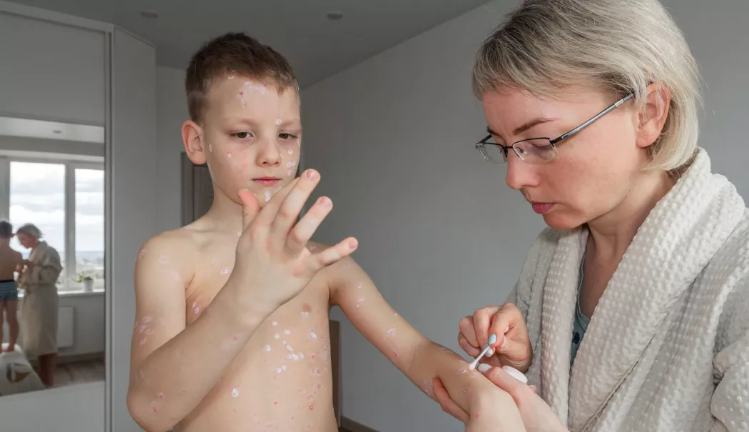 Rujeola revine în forță. România are cele mai multe cazuri din Uniunea Europeană - x-vaccinare-1784286044.webp