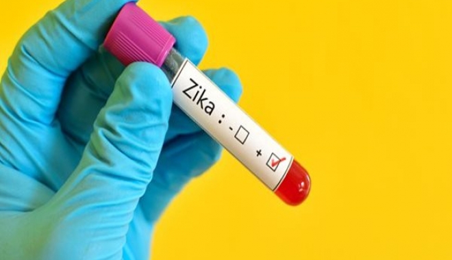 Cercetătorii anunță primul VACCIN împotriva Zika - zika-1469018138.jpg