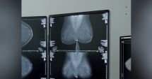 Stire din Social : Mamografii gratuite pentru depistarea cancerului la sân, la Năvodari