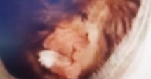 Stire din Eveniment : VIDEO. Imagini șocante cu copilul mușcat de un câine, în timp ce venea de la școală