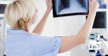 Stire din Sănătate : Investigații pentru depistarea cancerului pulmonar, la MEDSTAR 2000