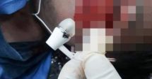 Stire din Tehnologie : Un adolescent de 16 ani a murit electrocutat, după ce a adormit cu căștile telefonului în urechi