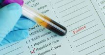 Stire din Sănătate : VEȘTI BUNE PENTRU BOLNAVII DE HEPATITĂ