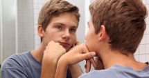 Stire din Sănătate : Acneea hormonală poate fi ameliorată, uneori, cu pilulele contraceptive
