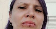 Stire din Actualitate : IMAGINEA ZILEI. O activistă rusă şi-a cusut gura în semn de protest faţă de războiul din Ucraina