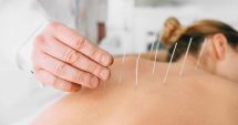 Stire din Sănătate : Efectele acupuncturii pentru organism se simt după cel puțin cinci ședințe