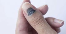 Stire din Sănătate : Fiți atenți la alunițele de sub unghii, să nu fie canceroase!