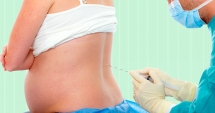 Stire din Sănătate : Tot ce trebuie să știi despre nașterea vaginală cu anestezie epidurală