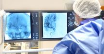 Stire din Sănătate : Angiografia cerebrală evaluează vasele de sânge din gât și creier