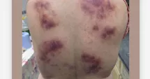 Stire din Eveniment : Curaj pedepsit cu pumnii. A sărit în ajutor și a fost lovită crunt
