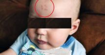 Stire din Actualitate : Medicii, uimiţi de semnul care i-a apărut unui bebeluş pe frunte, după naştere
