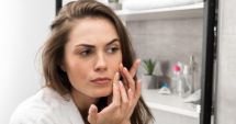 Bubițele din jurul gurii pot apărea din cauza folosirii excesive a produselor cosmetice