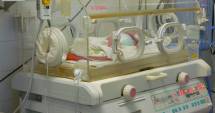Stire din Sănătate : Caz incredibil:  fetițe siameze născute  în maternitatea Constanța