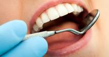 Ce alegem: implant sau punte dentară?