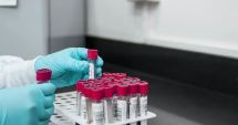 Stire din Sănătate : Când ar trebui să mergeți la un consult hematologic