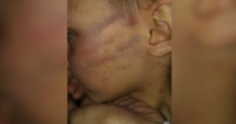 Stire din Actualitate : CAZ CUTREMURĂTOR! Băiețel bătut de iubitul mamei, pentru că a deschis mai devreme un cadou pus sub bradul de Crăciun