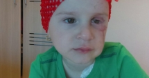 Stire din Sănătate : O fetiță de trei ani se luptă cu cancerul la ochi. Haideți s-o ajutăm!