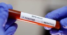 Stire din Social : Angajată a ministerului Sănătății, infectată cu coronavirus. 12 persoane au fost izolate la domiciliu