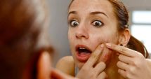 Stire din Sănătate : Ce riscaţi dacă vă stoarceţi coşurile