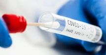 Stire din Actualitate : Teste gratuite anti-Covid în 120 de farmacii din România. Andrei Baciu: "Demersurile vor continua"