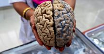 Stire din Sănătate : Semnal de alarmă al dr. Vlad Ciurea. Dependența de tehnologie = atrofierea creierului