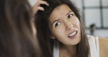 Stire din Sănătate : Dermatita seboreică este confundată foarte des cu mătreața