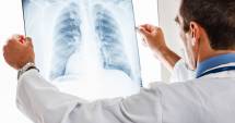 Stire din Sănătate : Durerea toracică  poate fi semn  al cancerului de plămâni